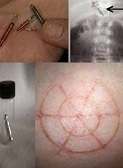 Impacts sur l'humains Marques corps humains
